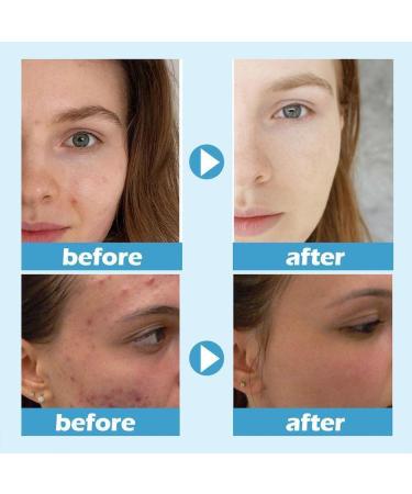 Jskin Beauty Hydramoist Ice Water Sleeping Mask 100g - Hydrating Overnight Mask - Buy Online on SooperMarket.com