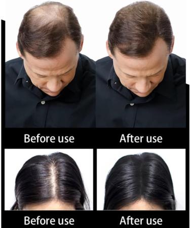1BAG Hair Building Fibers Instant Hair Loss Treatment Color Powder Conceal Thinning Hair Add Volume For Both Men & Women(Black)  - Buy Online on SooperMarket.com