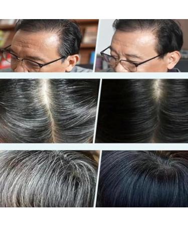 Black Fruit Hair Dye Cream for Grey Hair Coverage | Natural Dark Brown Hair Color for Men & Women - Shop Now - Buy Online on SooperMarket.com