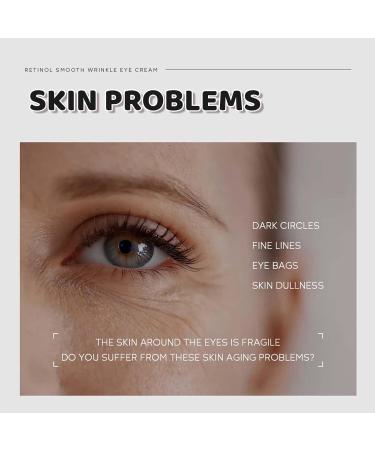 Retinol Eye Cream Dark Circle Eye Cream For Puffy Eyes Caffeine Eye Cream Anti Aging Eye Bags Remover And Anti Wrinkle Brightening Eye Cream Fine Lines Reduction Eye Contour Firming Eye Cream. - Buy Online on SooperMarket.com