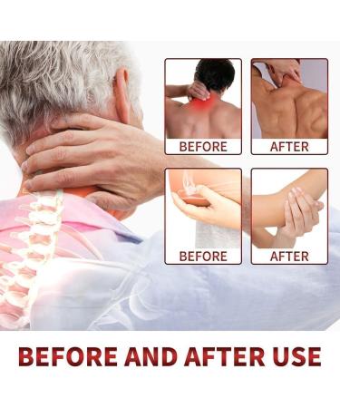 Bee Venom Psoriasis Cream New Zealand Bee Venom Cream Bee Venom Wart and Tag Remover Fast-Acting Relief Bee Venom Cream Psoriasis Cream Soothing Psoriasis Cream (60g) - Buy Online on SooperMarket.com
