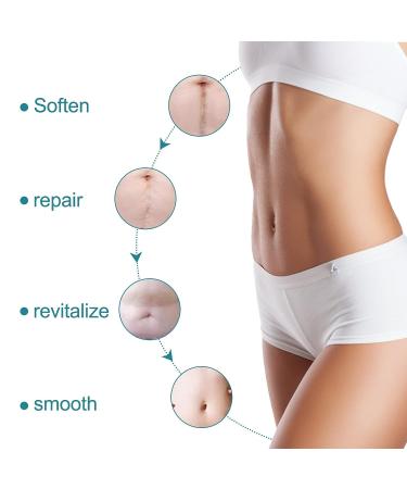 WUHEMA Silicone Scar Tape Roll - Soften, Flatten, and Remove Scars - Reusable and Washable - for Acne, Cesarean Section, Keloid, and Surgery Scars - Buy Online on SooperMarket.com