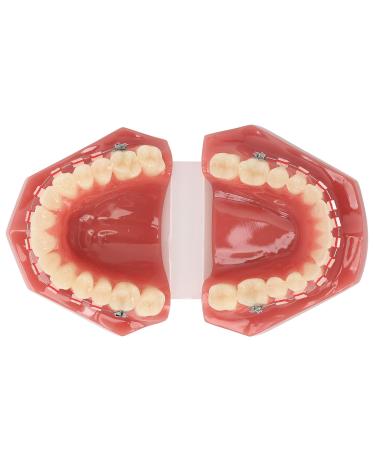 Orthodontic Demonstration Model for Dental Research | Metal Wires & Ceramic Brackets | Teaching Aids for Adults - Buy Internationally - Buy Online on SooperMarket.com
