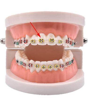 Orthodontic Ligature Rubber Bands - Multi-Color O-rings for Braces - Buy Online on SooperMarket.com