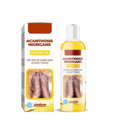 Extra Strong Peeling Oil Chemical Exfoliant For Face Body Exfoliant Yellow Peeling Oil Peeling Oil Reduces Wrinkles and Stretch Marks Removes Dead Skin Marks
