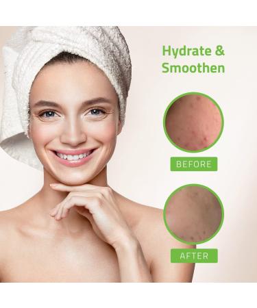 Yeouth Hyaluronic Acid Plus 1 fl oz - Hydrating Serum for Plump Skin - Buy Online on SooperMarket.com