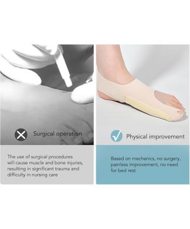 Adjustable Smoothing Iron for Large Toes | Hallux Valgus & Hammer Toe Corrector | Comfortable Friction Relief | Bale Toe (L Left Foot) - Buy Online on SooperMarket.com