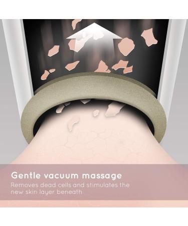 HoMedics Radiance Microdermabrasion Rose Gold - Professional Quality Salon Grade Deep Skin Exfoliation at Home Fast Treatment for Normal + Sensitive Skin Diminish Wrinkles Revitalise Skin HoMedics Radiance Microdermabrasion Rose Gold Professional Quality  - Buy Online on SooperMarket.com