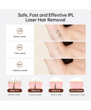 Laser Hair Removal Device - Sextupole Technology Ice Cooling Results in 2 Weeks - Painless & Safe for Men & Women - Full Body Use - Buy Online on SooperMarket.com