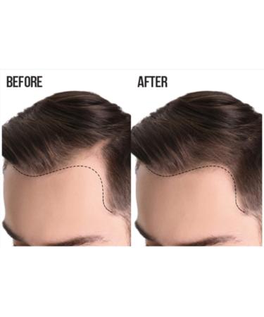 Difeel Men's Ultra Growth Basil & Castor Hair Oil 2.5 oz - Promotes Hair Growth & Thickness - Buy Online on SooperMarket.com