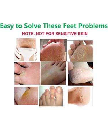 BOMPOW Olive Scented Foot Peel Socks - Soft Baby Feet in 3-7 Days - 2 Pairs - Buy Online on SooperMarket.com