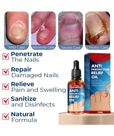 2PCS German Toenailplus Anti Paronychia Relief Oil - Nail Repair for Damaged Thick Nails - Buy Online on SooperMarket.com