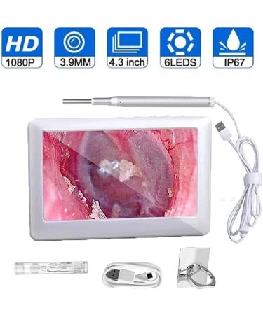 Marycan 3.9mm HD Ear Wax Removal Otoscope with 6 LED Lights - 4.3 Inch Screen Endoscope Ear Tip for Children and Adults - Buy Online on SooperMarket.com