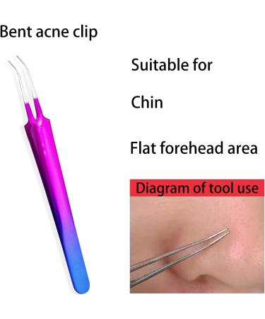 9PCS Blackhead Remover Tool Kit Professional Pimple Popper Tool -Treatment for Pimples Blackheads Blemish Zit Removing Forehead and Nose(Colorful) - Buy Online on SooperMarket.com