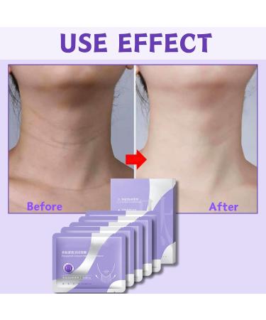 Squalane Neck Mask Neck Wrinkle Patches Dark Neck Remover Neck Firming Anti Aging Neck Mask Anti Wrinkle Patches For Skin Anti Ageing Neck Wrinkle Patch For Neck Tightening And tightening - Buy Online on SooperMarket.com