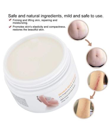 Stretch Stripes Cream 120g | Remove Stretch Marks Pregnancy Scars & Acne | Maternity Repair Treatment - Buy Online on SooperMarket.com