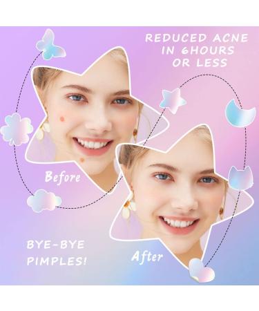 Acne Patches with Natural Green Algae & Tea Tree Oil | Hydrocolloid Treatment for Zits Pimples & Blemishes - Fast International Shipping - Buy Online on SooperMarket.com