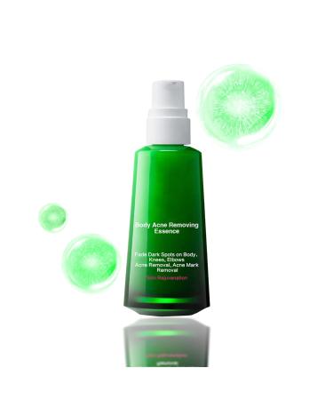 Trendyfave Dark Spot Correcting Glow Serum Skin Tag Removal Age Spot Remover For Face Scar Treatment Pore Minimizer Serums Skincare Contains Tea Tree Oil Vitamin E Body Acne Treatment 30ml