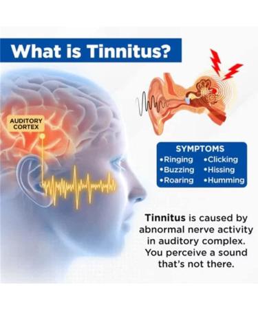2023 Newest MRIMED Luhaka Acupeace Tinnitus Relief Device Biancat Auricalm Tinnitus Relief Device Acupeace Anti Tinnitus Relief Ear Clip (1) - Buy Online on SooperMarket.com