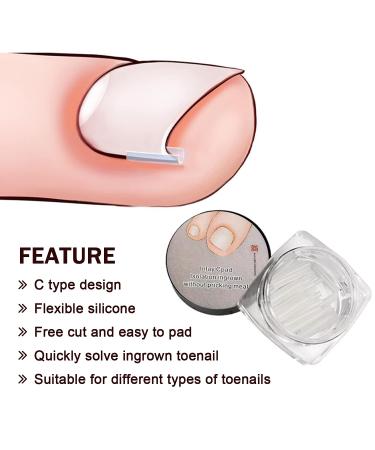 60+2 Pack Ingrown Toenail Treatment Set - Includes Corrector Strips, Lifter, and Nail Clipper - Professional Ingrown Toenail Correction Tool - Buy Online on SooperMarket.com