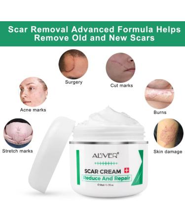 Scar Repair Cream | Acne Scar Removal & Pigmentation Corrector | Stretch Mark Remover | Skin Whitening | Scar Care - Buy Online on SooperMarket.com