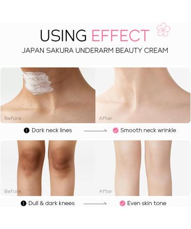Underarm Whitening Cream Sakura Underarm Whitening Products Skin Lightening Cream Armpit Whitening Cream Boost Collagen Skin Whitening Cream Lightening Cream For Armpit Knees Elbows Legs - Buy Online on SooperMarket.com