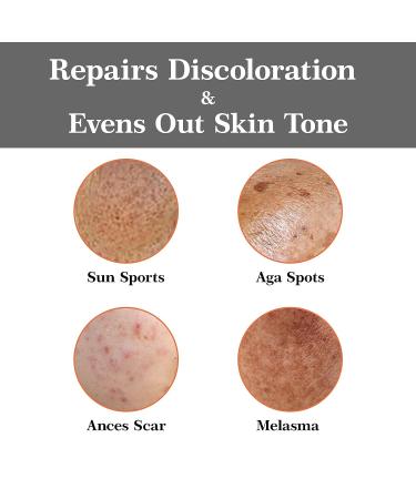 Kojic Acid & Turmeric Dark Spot Corrector Serum | Brightening Face & Body | Sun Spot Remover - 30ml - Buy Online on SooperMarket.com