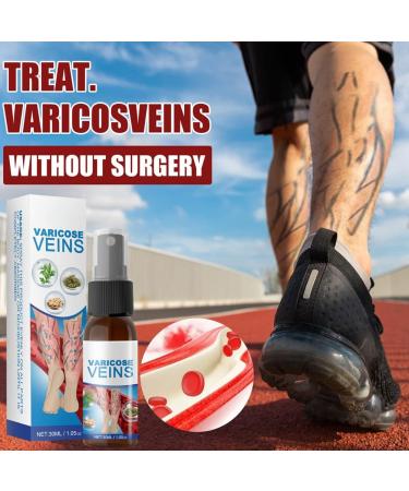 3 Pieces VeinHealing Varicose Vein Spray - Remove Varicose & Spider Veins Soothing Treatment for Legs 30ml | Improve Blood Circulation - Buy Online on SooperMarket.com
