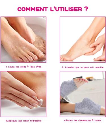 Buy 3 Pairs Moisturizing Gel Heel Socks | Soft Open Toe Socks for Dry Skin Care | International Shipping Available - Buy Online on SooperMarket.com