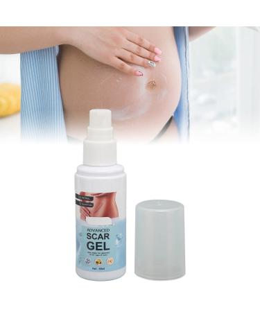 Marks Remover Stretch Stretch Marks Gel 2Pcs Stretch Marks Remover 50Ml Allantoin Vitamin E Hydrate Renew Smoothing Scar Gel Stretch Marks Scars Prevention Remover for Burn Surgery Scar Gel Scars