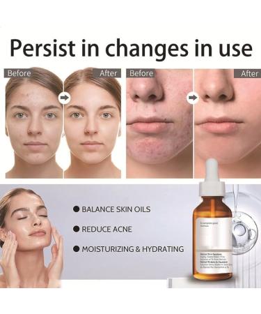 Retinol Serum For Face/Neck/Eyes - Retinol 1% in Squalane 30ml - High-Strength Face Serum for Activate Skin- Anti Aging Facial Serum for Moisturizing Fine Line Skin Repair - Buy Online on SooperMarket.com