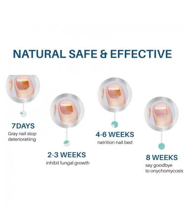 Nail Skin Care Oil - Strengthening & Protecting Cuticle Oil for Brittle Nails | Boost Nail Health & Structure - 30ml - Buy Online on SooperMarket.com