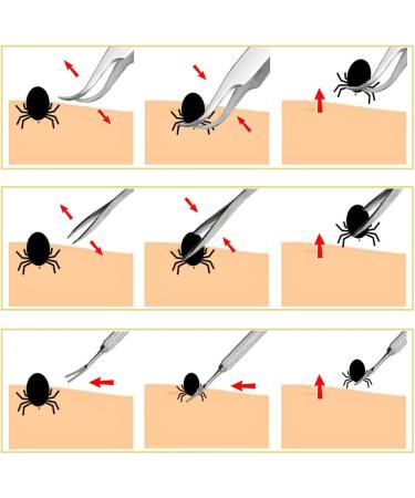 3PCS Stainless Steel Tick Remover Tool Set for Dogs, Cats, Horses - Safe Tick Removal Kit with Double-sided Tweezer, Tick Hook, Tick Tweezer - In Iron Box - Christmas Gift - Buy Online on SooperMarket.com