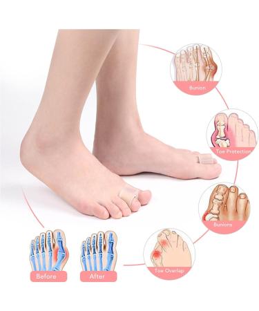 Toe Corrector Spacer: Bunion Preventing Ring Sleeves - 3 Pair Set for Nail Problems - Buy Online on SooperMarket.com