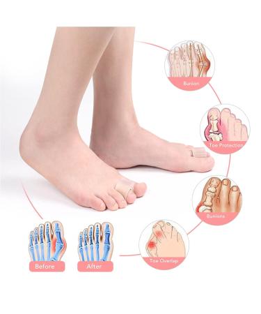 Bunion Corrector Toe Spacer SEBS - Relieve Pressure, Prevent Friction, Comfortable Fit for Overlapping Toes - Nail Problem Relief - Buy Online on SooperMarket.com