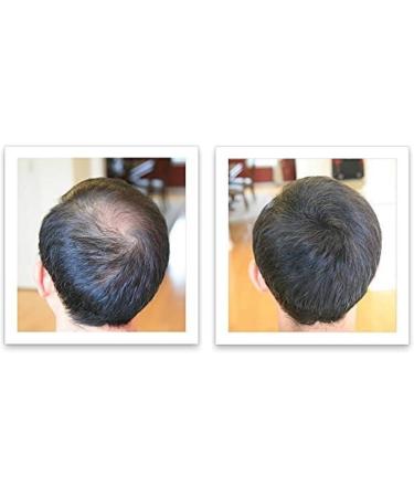 Caboki Hair Loss Concealer Hair Building Fiber 25g (Black) - Buy Online on SooperMarket.com