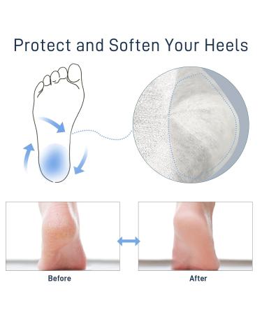 Wookite Moisturizing Heel Socks Gel - Open Toe Spa Foot Care for Dry Cracked Heels - 4 Pairs for Men & Women - Gray - Buy Online on SooperMarket.com