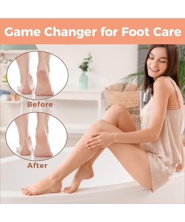 Professional Foot File Scrubber Pedicure - Callus Remover for Feet | Easkep Foot Grater Rasp Scraper for Corns and Dead Skin (Golden) - Buy Online on SooperMarket.com