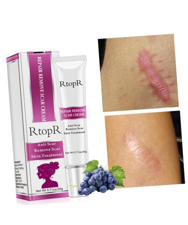 Healvian Scar Cream 3 Pcs Set - Skin Repair & Eraser - Blemish & Wrinkle Cream - Safe Scars Removal - Assorted Colors - 13.1x3cmx3pcs - Buy Online on SooperMarket.com