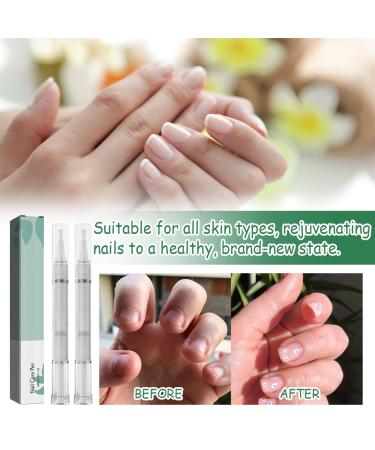 Hongecb Nail Care Pen - 2 PCs | Strengthen & Protect Your Nails | Health Routine Nail Care | Easy Application for Daily Use - Buy Online on SooperMarket.com
