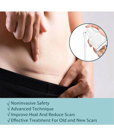 Stretch Marks & Scar Gel 50ml - Safe Vitamin E Formula for Effective Removal - Buy Online on SooperMarket.com