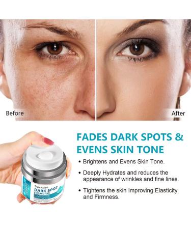 Fast-Acting Dark Spot Remover for Face & Body | Hyperpigmentation & Melasma Corrector | Even Skin Tone | Age Spot Treatment for Men & Women - Buy Online on SooperMarket.com