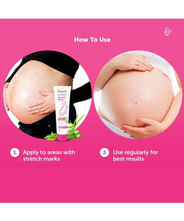 Mama's Choice Stretch Mark Cream for Pregnant Moms - Prevents & Reduces Stretch Marks, Soothes Itchy Skin - Paraben & Alcohol Free - 3.38 oz - Buy Online on SooperMarket.com