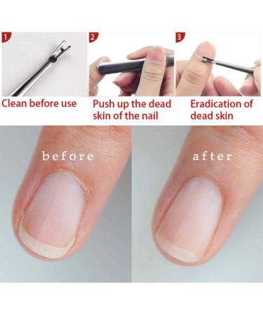 Stainless Steel Cuticle Remover & Pusher for Nails - Anti-Slip Dead Skin Cutter - Buy Online on SooperMarket.com