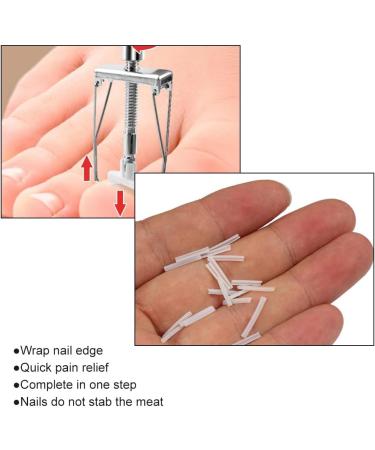 KARELLS Ingrown Toenail Correction Set Ingrown Toenails Set 12 Pieces Ingrown Toenail Lifter Ingrown Toenail Correction Treatment Set for Ingrown Toenails - Buy Online on SooperMarket.com