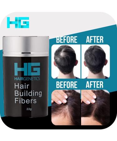 Hair Genetics Black Hair Fibres (22g) - Hair Loss Treatment & Thinning Hair Solution - Buy Online on SooperMarket.com