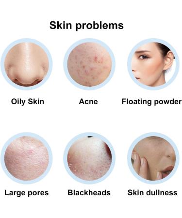 Oil Absorbing Roller Volcanic Rock Oil Oil Absorbing Face Roller Reusable Dual Heads Oil Control Volcanic Skin Roller for Face Makeup - Buy Online on SooperMarket.com