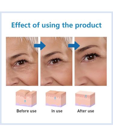 Hyalu B5 Serum Hyaluronic Acid B5 Serum Anti Aging Serum Face Serum Concentrate Hyaluronic Acid Serum for Face - Anti Aging Instant Face Firming & Plumping Face Fade Fine Lines 30ml - Buy Online on SooperMarket.com