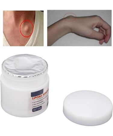 Lipoma Removal Cream | Cellulite Relief | Diminish Inflammation | 0.7oz Skin Care Solution - Buy Online on SooperMarket.com