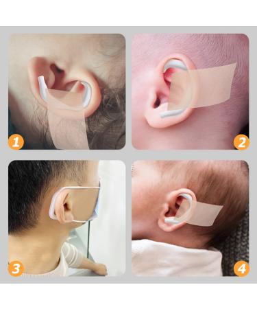 Protruding Ear Corrector | Silicone Support for Misshapen Ears | 5 Pairs - Buy Online on SooperMarket.com